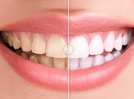 Before & After Images Comparison WordPress Plugin